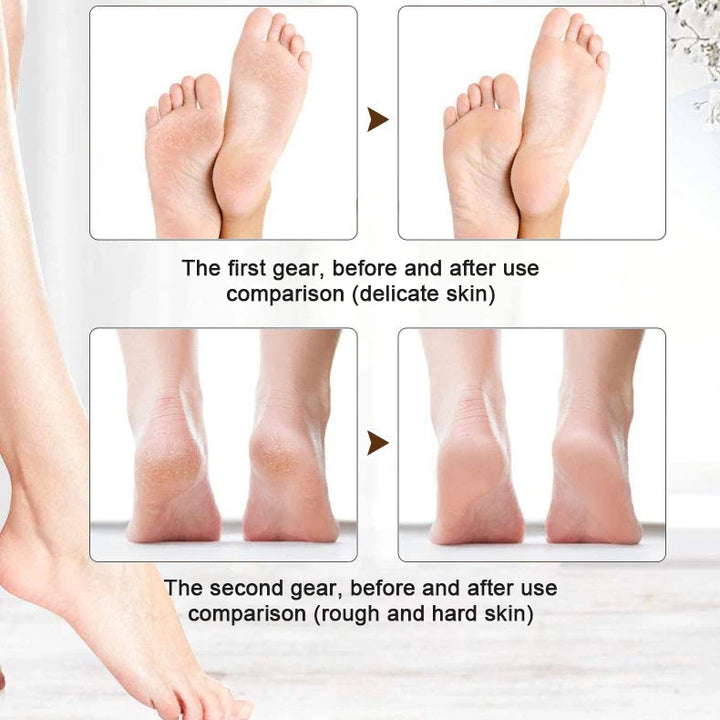 Electric Callus Removers for Feet